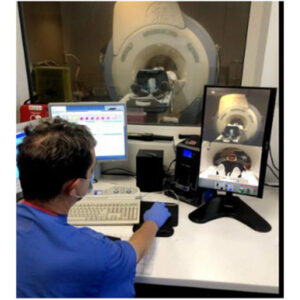 MRI Patient Motion Tracker