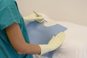 Sterile Fenestrated Radiation Attenuation Shadow Pad